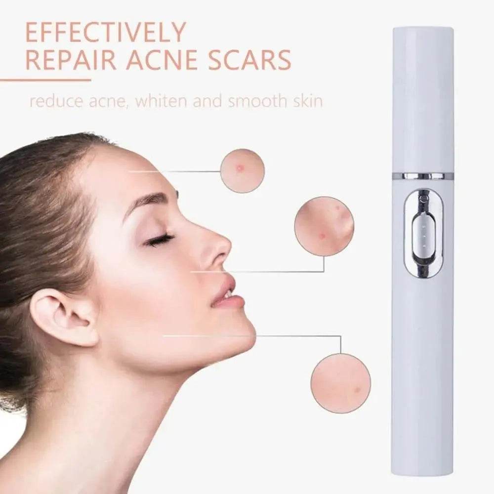 Blue Light Therapy Acne Laser Pen Soft Scar Wrinkle Removal Treatment Device Skin Care Beauty Equipment - ProTrendyz