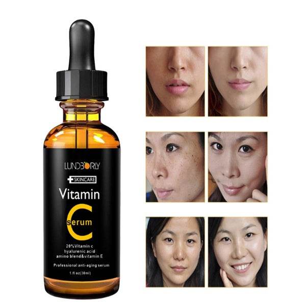 Vitamin C Vitamin E - ProTrendyz
