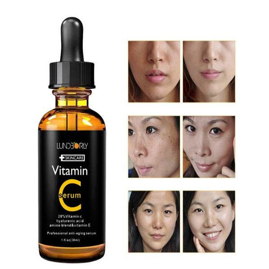 Vitamin C Vitamin E - ProTrendyz