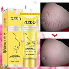 Rose go to stretch marks cream for Pregnancy Fat Belly Growth - ProTrendyz