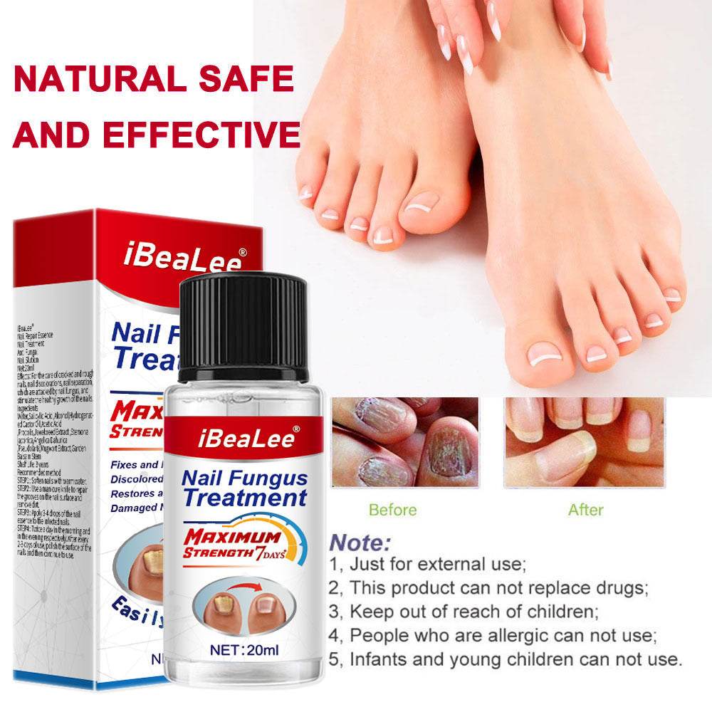 Thickening Of Special Bacteriostatic Liquid For Onychomycosis - ProTrendyz