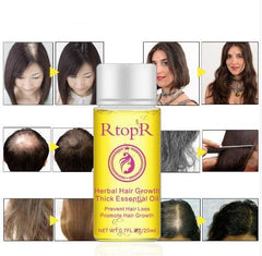 Fast Powerful Hair Growth Products Essential Oil Liquid Treatment Preventing Hair Loss Hair Care 20ml - ProTrendyz