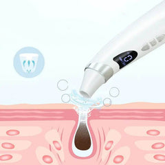 Electric Visual Blackhead Suction Instrument Household Cleansing Pore Cleaner For Skin Equipment Skin Care Tool - ProTrendyz