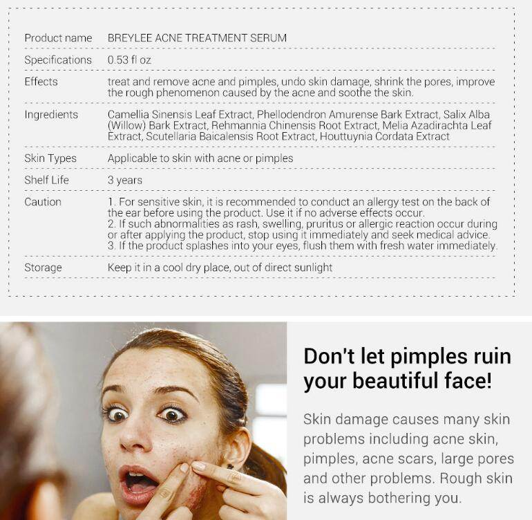 Acne Treatment Serum Facial Repair Oil - ProTrendyz