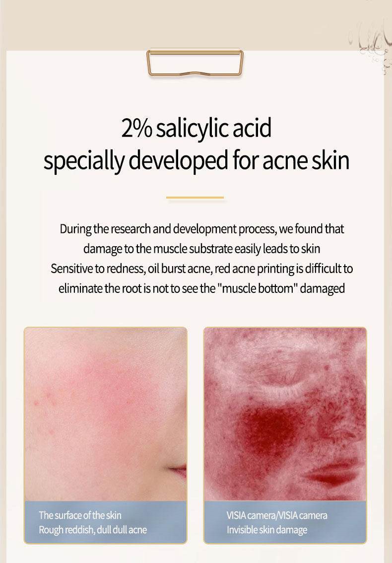 Acne Removing Salicylate Products - ProTrendyz