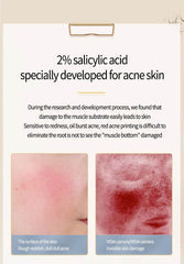 Acne Removing Salicylate Products - ProTrendyz