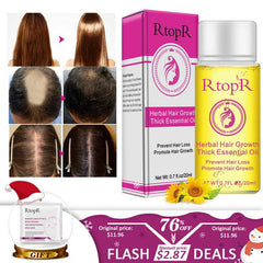 Fast Powerful Hair Growth Products Essential Oil Liquid Treatment Preventing Hair Loss Hair Care 20ml - ProTrendyz