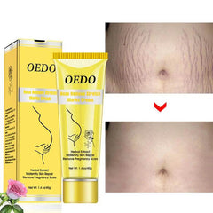 Rose go to stretch marks cream for Pregnancy Fat Belly Growth - ProTrendyz