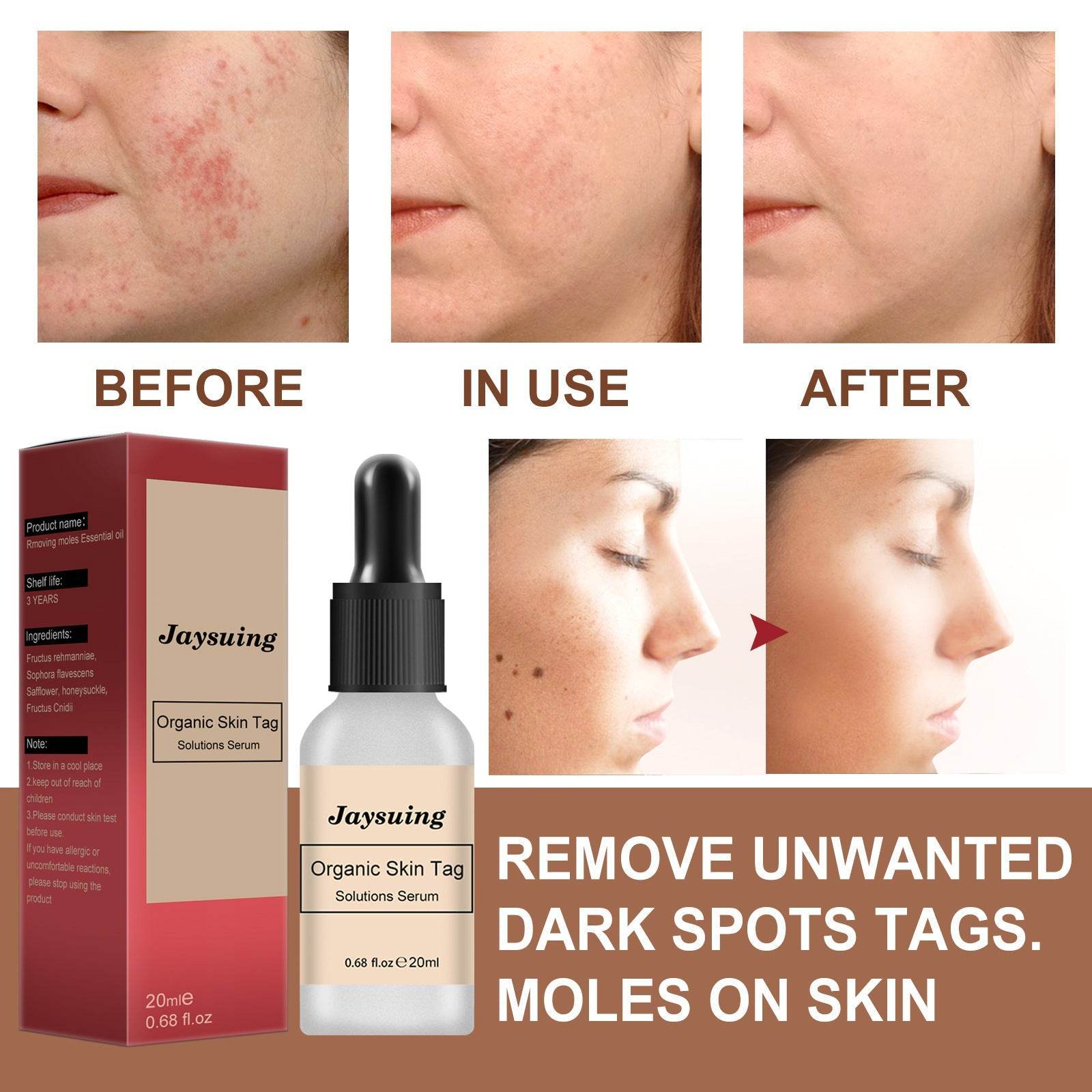 Anti-mole Potion Repair Smooth Skin Wart Care - ProTrendyz