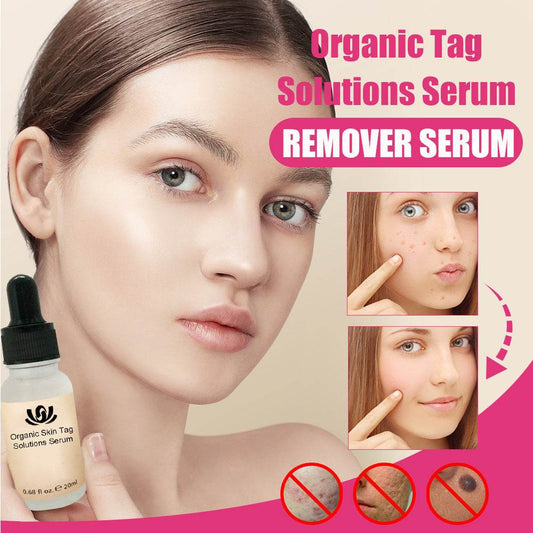 Organic Tags Solutions Serum No Trace Painle Skin Tag Remover Serum Mole Removal Cream Painless Face Wart Mole Freckle - ProTrendyz