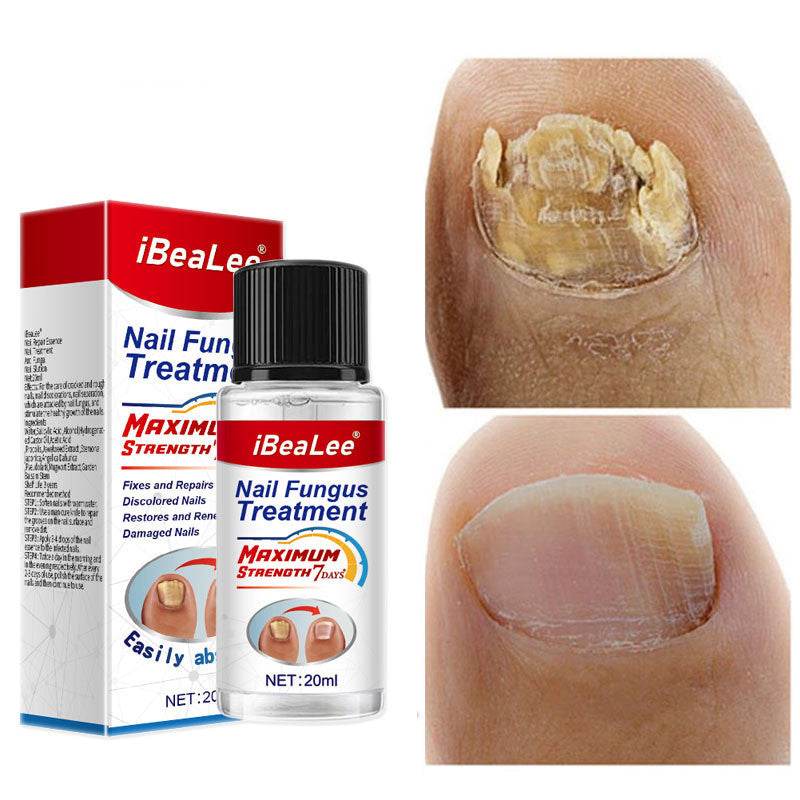Thickening Of Special Bacteriostatic Liquid For Onychomycosis - ProTrendyz