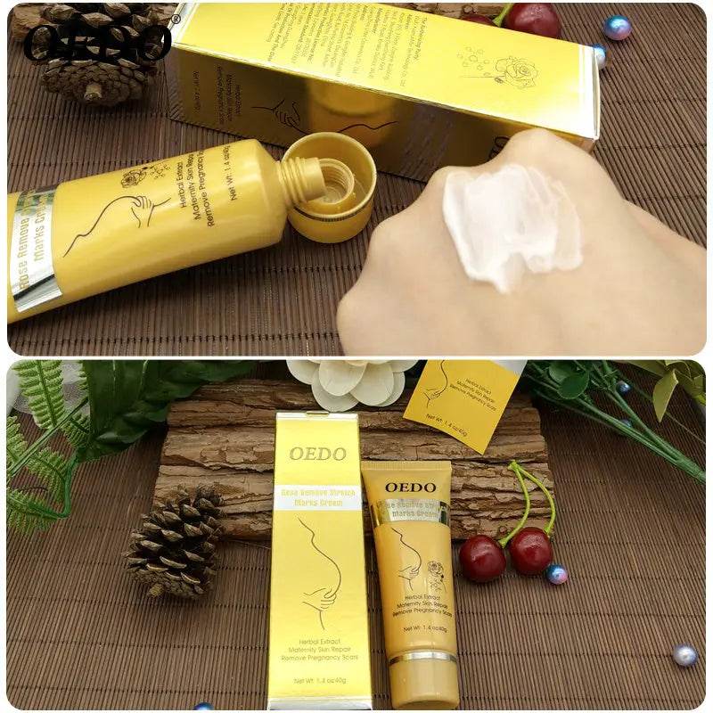 Rose go to stretch marks cream for Pregnancy Fat Belly Growth - ProTrendyz