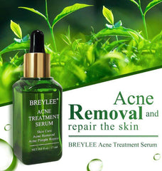 Acne Treatment Serum Facial Repair Oil - ProTrendyz