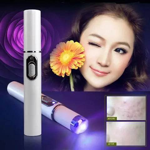 Blue Light Therapy Acne Laser Pen Soft Scar Wrinkle Removal Treatment Device Skin Care Beauty Equipment - ProTrendyz