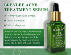 Acne Treatment Serum Facial Repair Oil - ProTrendyz