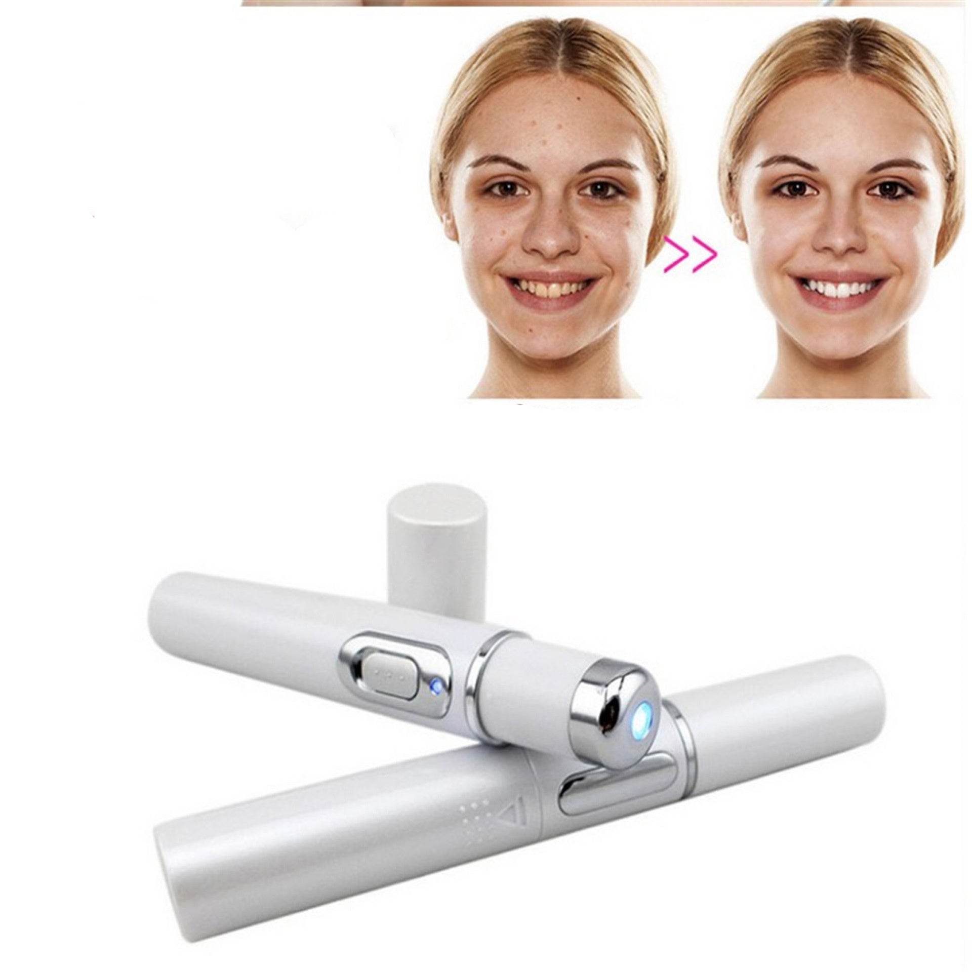 Wrinkle Blemish Pore Acne Scar Remover Pen - ProTrendyz