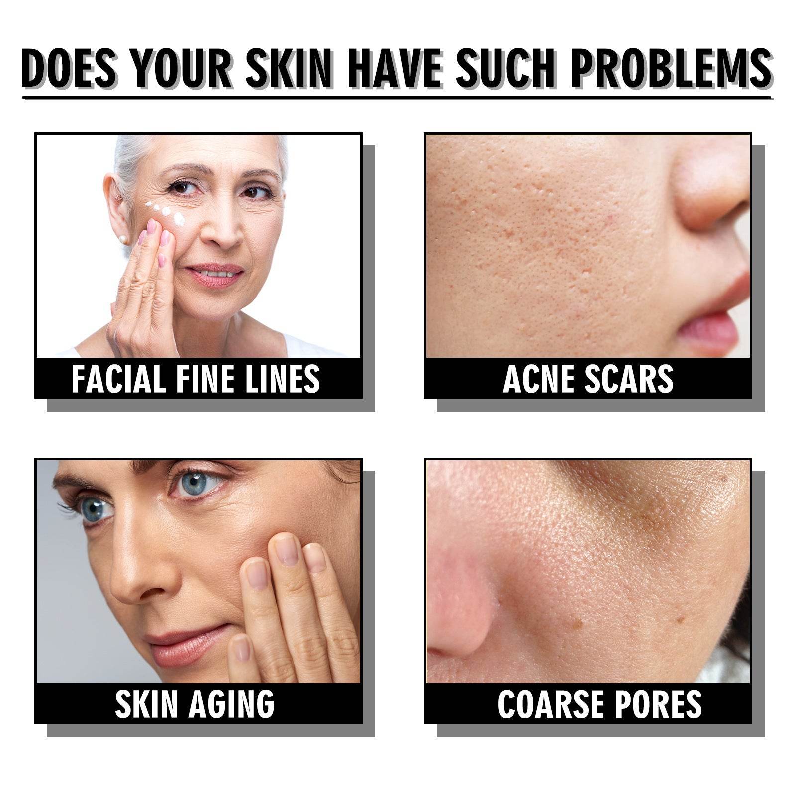 Snail Cream Fading Wrinkle French Lines Replenishment Firming Skin Anti-Aging - ProTrendyz