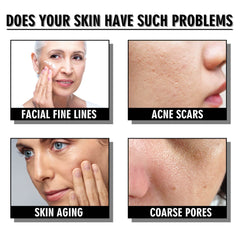 Snail Cream Fading Wrinkle French Lines Replenishment Firming Skin Anti-Aging - ProTrendyz