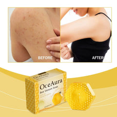 Skin Moisturizing Brightening Improve Skin Quality Bath Body Soap - ProTrendyz