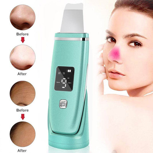 Ultrasonic Vibration Blackhead Remover Deep Cleansing Face Scrubber Pore Cleaner Lifting Machine Facial Led Peeling Shovel - ProTrendyz