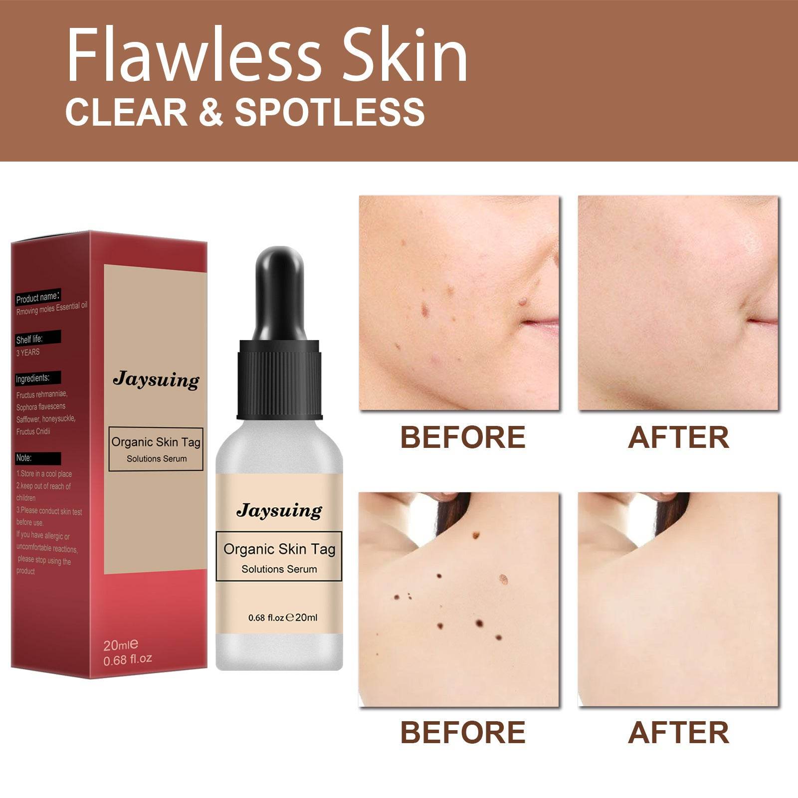 Anti-mole Potion Repair Smooth Skin Wart Care - ProTrendyz