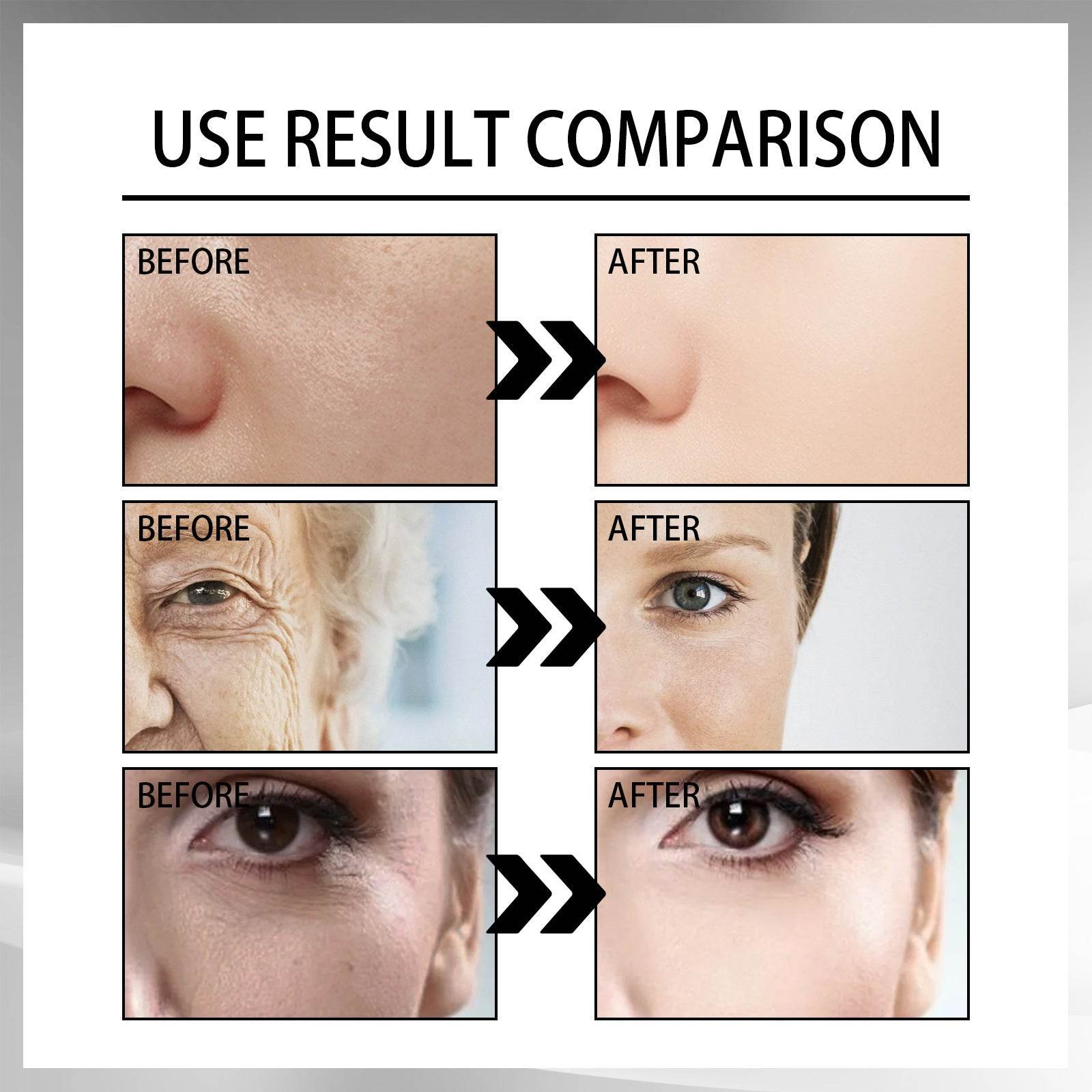 Snail Cream Fading Wrinkle French Lines Replenishment Firming Skin Anti-Aging - ProTrendyz