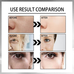 Snail Cream Fading Wrinkle French Lines Replenishment Firming Skin Anti-Aging - ProTrendyz