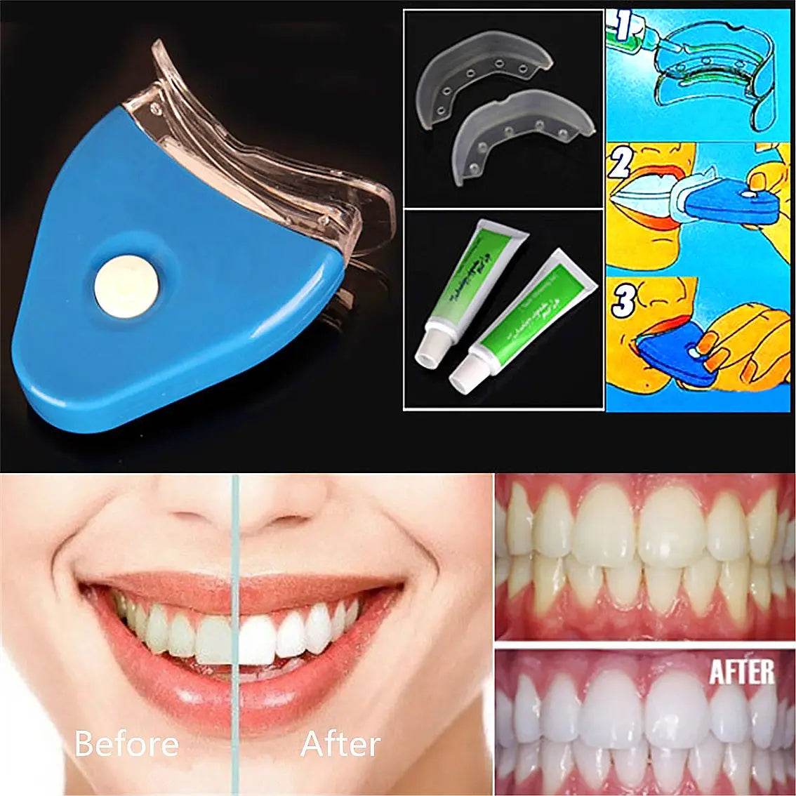 Oral Gel Teeth Tooth Whitening Whitener Dental Bleaching LED - ProTrendyz