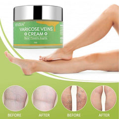 Vein Cream Red Blood Streaks Repair Earthworm Leg Bruises Bulge Relief Pain Safflower Skin care lotion Varicose Cream - ProTrendyz