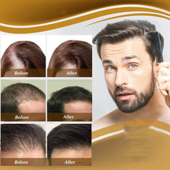 Anti Hair Loss Hair Nourishing Liquid Hair Firming And Hair Increasing - ProTrendyz