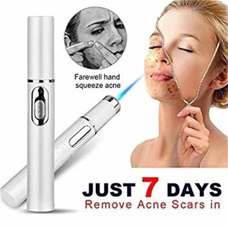 Blue Light Therapy Acne Laser Pen Soft Scar Wrinkle Removal Treatment Device Skin Care Beauty Equipment - ProTrendyz