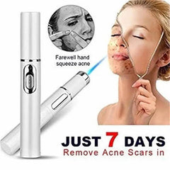 Blue Light Therapy Acne Laser Pen Soft Scar Wrinkle Removal Treatment Device Skin Care Beauty Equipment - ProTrendyz