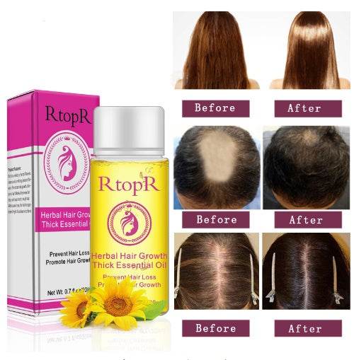 Fast Powerful Hair Growth Products Essential Oil Liquid Treatment Preventing Hair Loss Hair Care 20ml - ProTrendyz