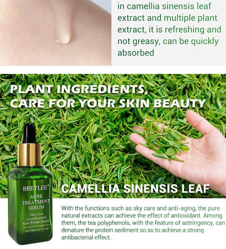 Acne Treatment Serum Facial Repair Oil - ProTrendyz