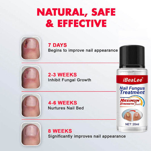 Thickening Of Special Bacteriostatic Liquid For Onychomycosis - ProTrendyz