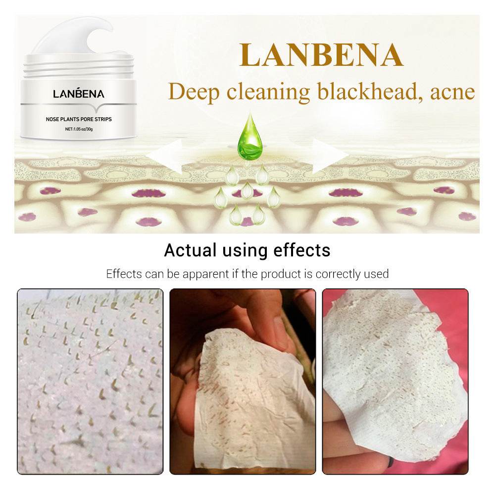Blackhead Nasal Membrane Sucking Blackhead Tearing To Remove Acne - ProTrendyz