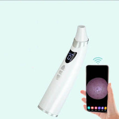 Electric Visual Blackhead Suction Instrument Household Cleansing Pore Cleaner For Skin Equipment Skin Care Tool - ProTrendyz