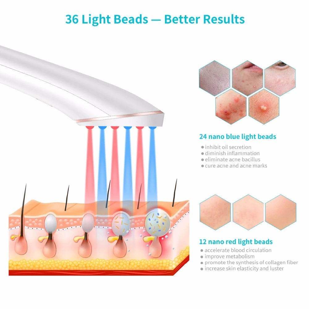 Acne Light Therapy Xpreen Wireless Rechargeable Light Acne Treatment Device Acne Clearing Eraser with Blue Light and Red Light - ProTrendyz
