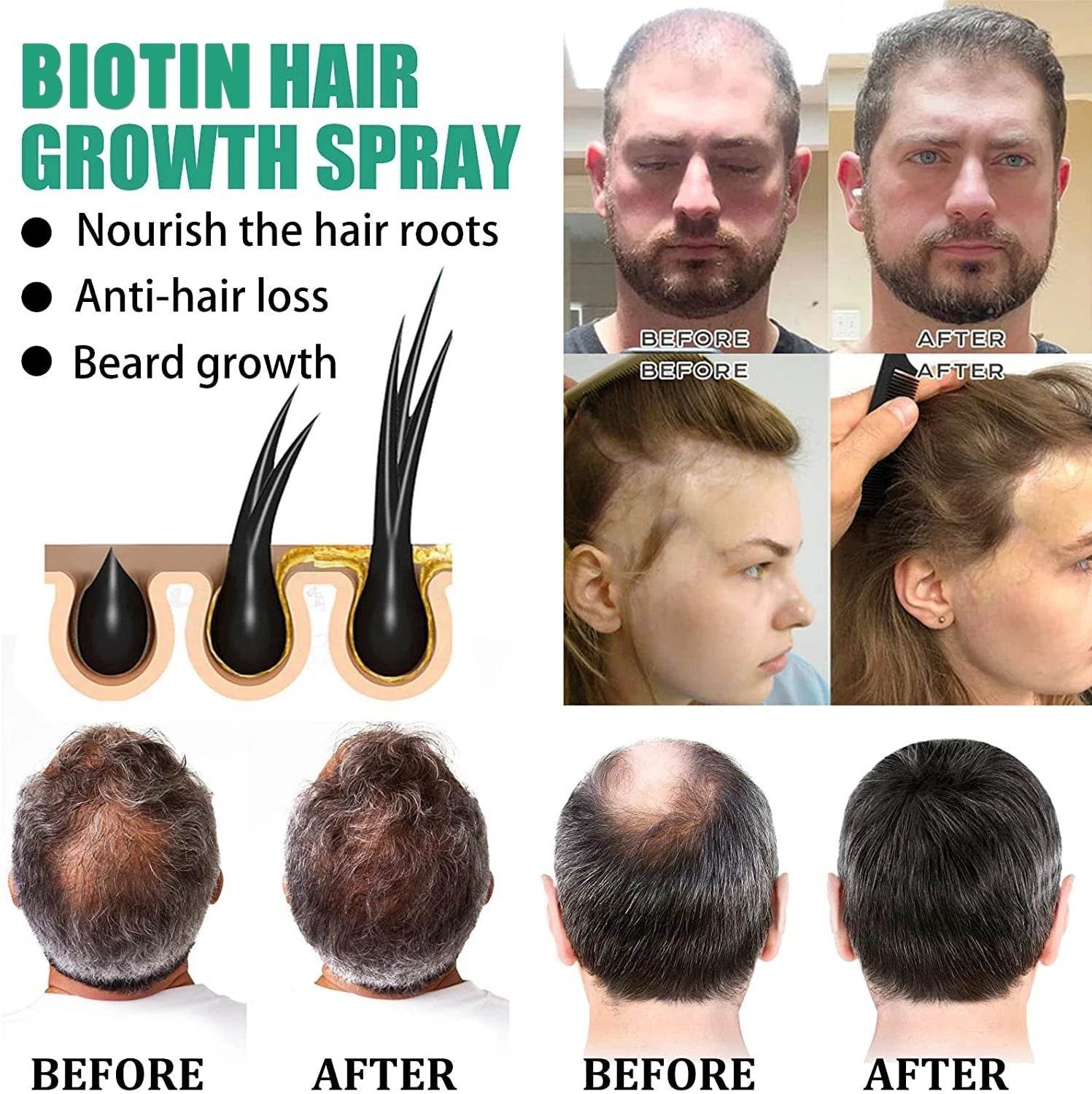 Anti Hair Loss Hair Nourishing Liquid Hair Firming And Hair Increasing - ProTrendyz