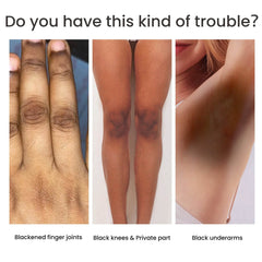 Women's Skin Pigmentation Care - ProTrendyz