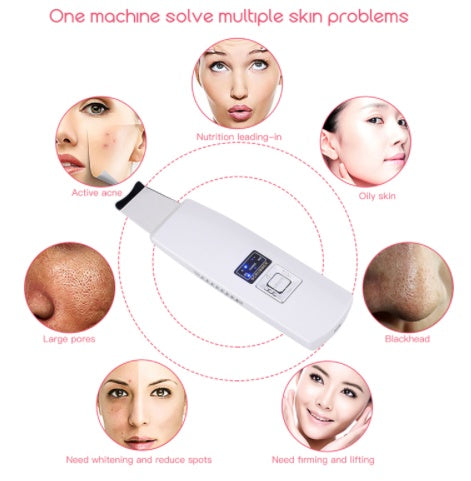 Ultrasonic Skin Scrubber Face Cleanser Blackhead Acne Removal Facial Spa Vibration Massager Ultrasound Peeling Clean Machine 394 ProTrendyz