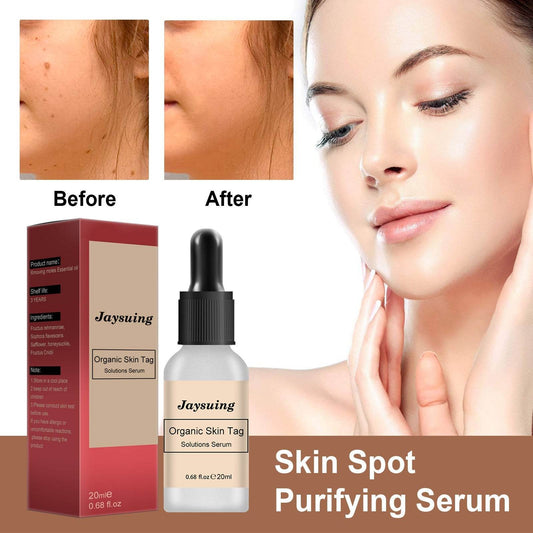 Anti-mole Potion Repair Smooth Skin Wart Care - ProTrendyz