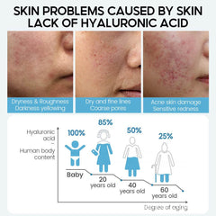 Hyaluronic Acid Face Serum Anti-Aging Shrink Pore Whitening Moisturizing Face Cream Dry Skin Care - ProTrendyz