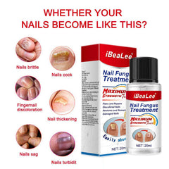 Thickening Of Special Bacteriostatic Liquid For Onychomycosis - ProTrendyz