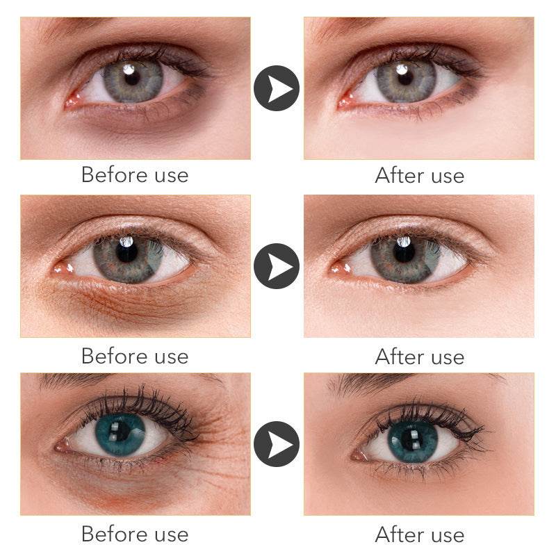 Beauty Eye Cream30mlwish Women's Skin Care Products - ProTrendyz