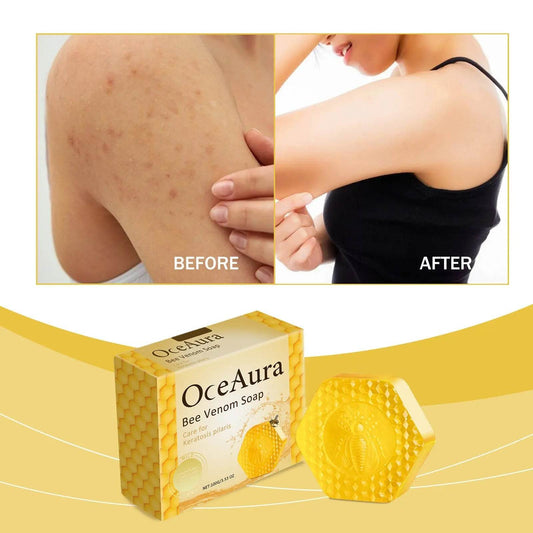 Skin Moisturizing Brightening Improve Skin Quality Bath Body Soap - ProTrendyz