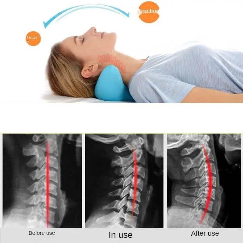 Cervical Spine Massage Pillow Gravity Acupressure Neck Massager Cervical Spine Pillow Neck Shoulder Massage Pillow Home Traction Corrector - ProTrendyz