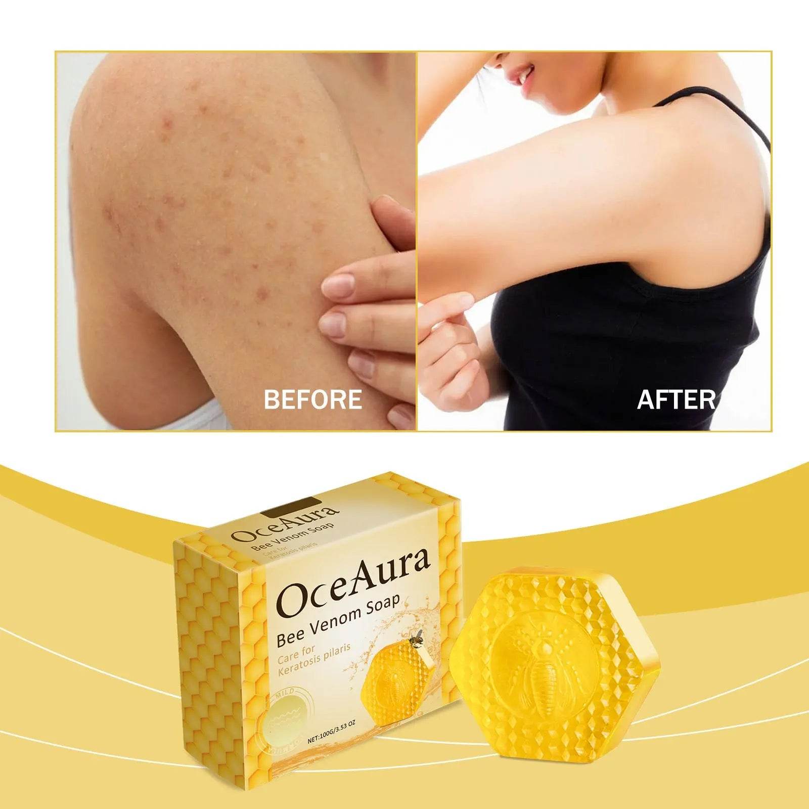 Skin Moisturizing Brightening Improve Skin Quality Bath Body Soap - ProTrendyz