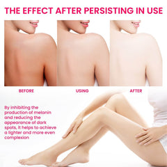 Women's Skin Pigmentation Care - ProTrendyz