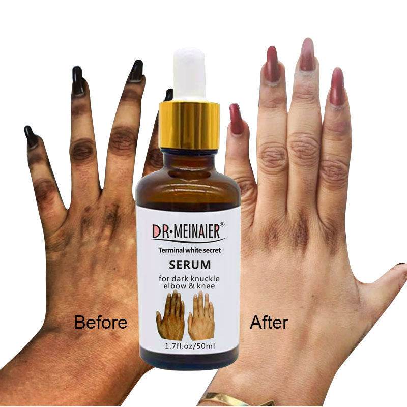 Hand Brightening Moisturizing Lotion South Africa India - ProTrendyz